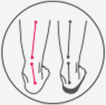 Orthofeet